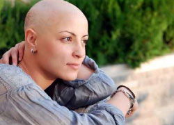 Alopecia por quimioterapia